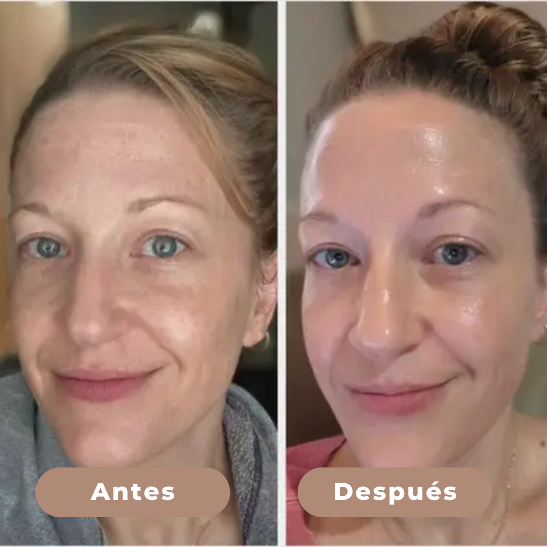 Dr Meloxin Peel Shot - Exfoliante Limpiador