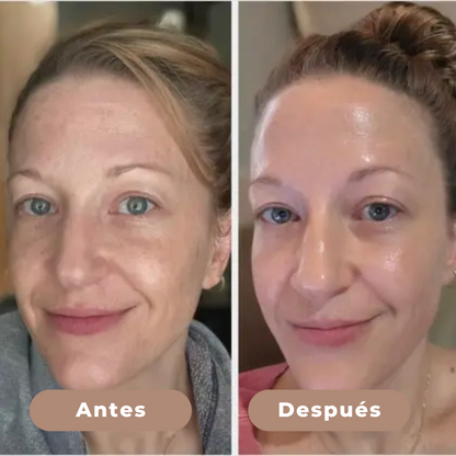 Dr Meloxin Peel Shot - Exfoliante Limpiador
